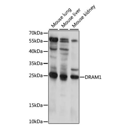 Western Blot - Anti-DRAM Antibody (A88940) - Antibodies.com