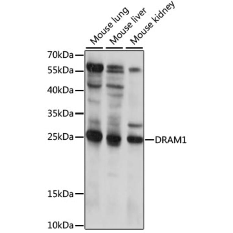 Western Blot - Anti-DRAM Antibody (A88940) - Antibodies.com