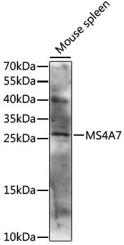 Western blot analysis of extracts of mouse spleen, using Anti-MS4A7 Antibody (A15495) at 1:1,000 dilution.
Secondary antibody: Goat Anti-Rabbit IgG (H+L) (HRP) (AS014) at 1:10,000 dilution.
Lysates / proteins: 25µg per lane.
Blocking buffer: 3% non-fat dry milk in TBST.
Detection: ECL Basic Kit (RM00020).
Exposure time: 10s.