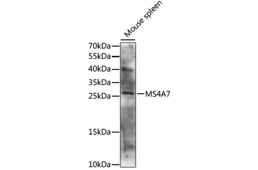Western Blot - Anti-MS4A7 Antibody (A88941) - Antibodies.com