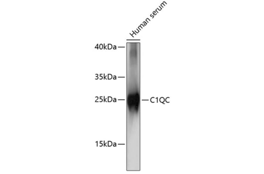 Western Blot - Anti-C1QC Antibody (A88942) - Antibodies.com