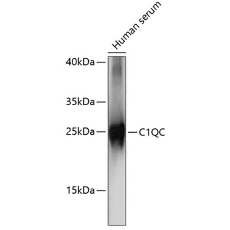 Western Blot - Anti-C1QC Antibody (A88942) - Antibodies.com