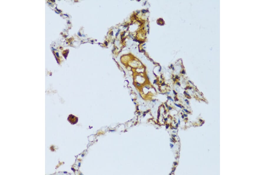 Immunohistochemistry - Anti-C1QC Antibody (A88942) - Antibodies.com