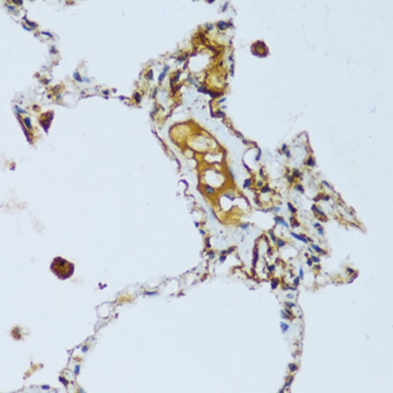 Immunohistochemistry - Anti-C1QC Antibody (A88942) - Antibodies.com