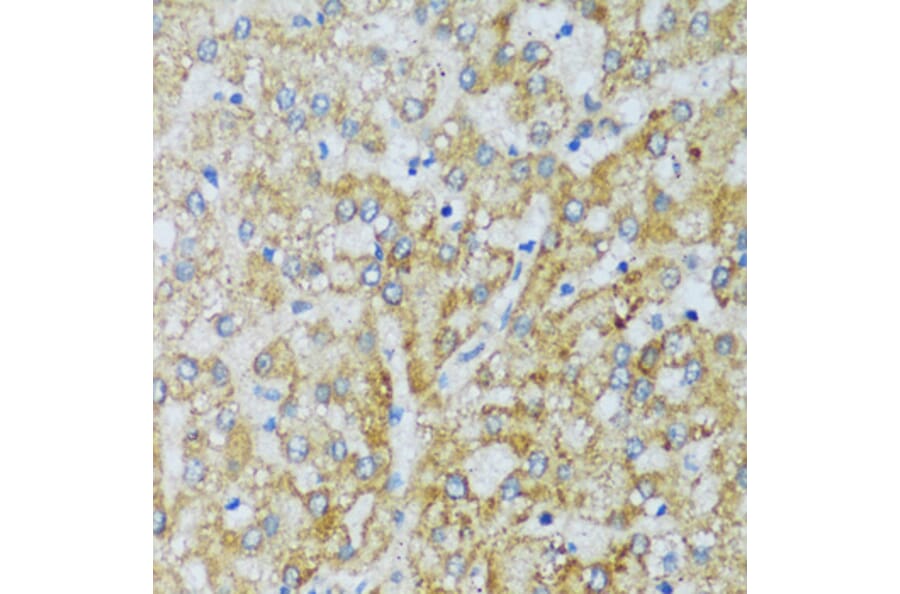 Immunohistochemistry - Anti-C1QC Antibody (A88942) - Antibodies.com