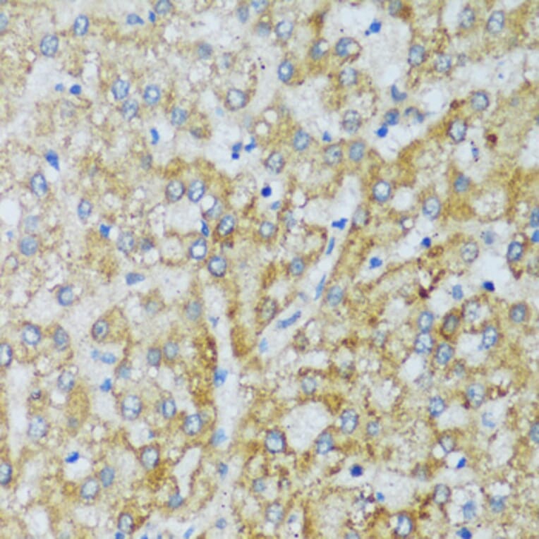 Immunohistochemistry - Anti-C1QC Antibody (A88942) - Antibodies.com
