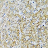 Immunohistochemistry - Anti-C1QC Antibody (A88942) - Antibodies.com