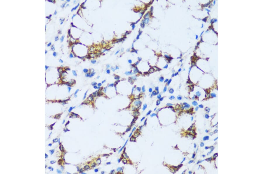 Immunohistochemistry - Anti-C1QC Antibody (A88942) - Antibodies.com