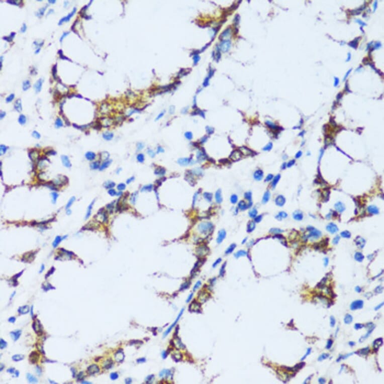 Immunohistochemistry - Anti-C1QC Antibody (A88942) - Antibodies.com