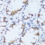 Immunohistochemistry - Anti-C1QC Antibody (A88942) - Antibodies.com