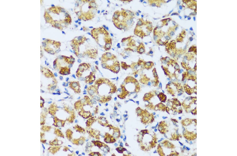 Immunohistochemistry - Anti-C1QC Antibody (A88942) - Antibodies.com
