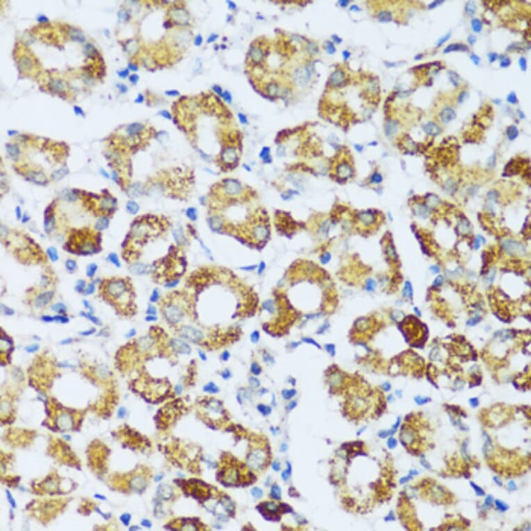 Immunohistochemistry - Anti-C1QC Antibody (A88942) - Antibodies.com