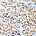 Immunohistochemistry - Anti-C1QC Antibody (A88942) - Antibodies.com