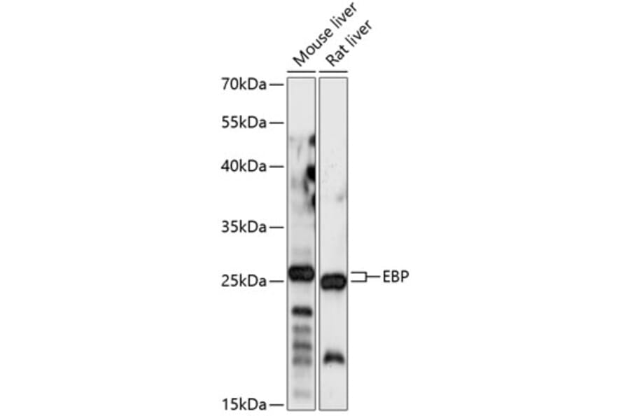 Western Blot - Anti-Emopamil binding protein Antibody (A88943) - Antibodies.com