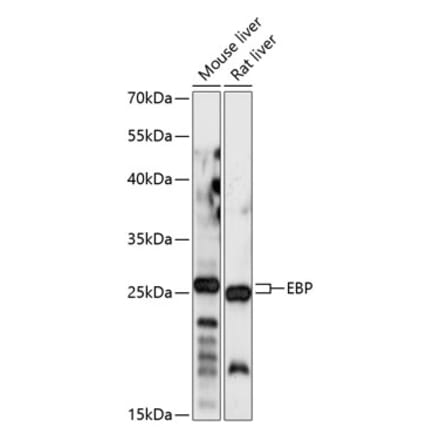 Western Blot - Anti-Emopamil binding protein Antibody (A88943) - Antibodies.com