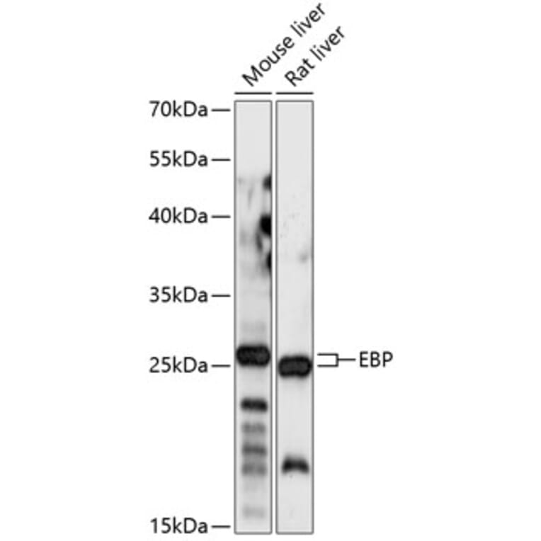 Western Blot - Anti-Emopamil binding protein Antibody (A88943) - Antibodies.com