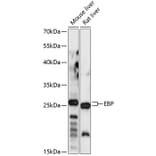 Western Blot - Anti-Emopamil binding protein Antibody (A88943) - Antibodies.com