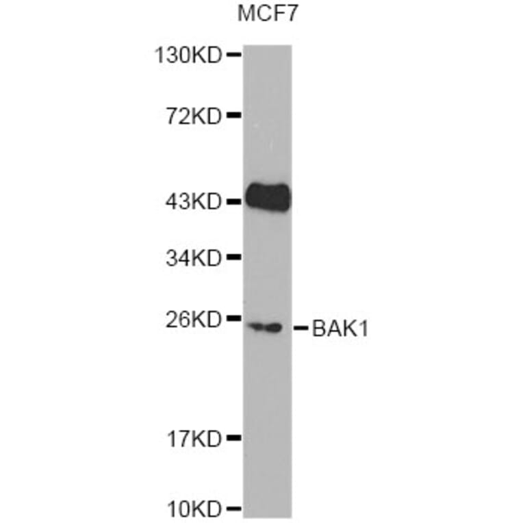 Western Blot - Anti-BAK1 Antibody (A13281) - Antibodies.com