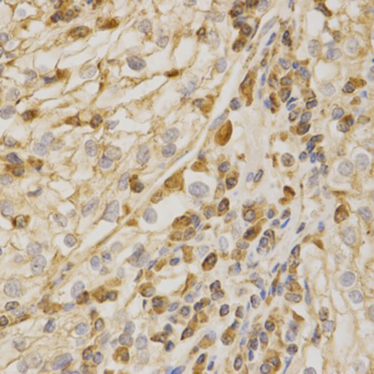 Immunohistochemistry - Anti-BAK1 Antibody (A13281) - Antibodies.com