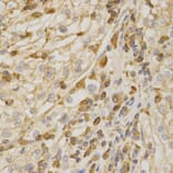 Immunohistochemistry - Anti-BAK1 Antibody (A13281) - Antibodies.com
