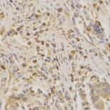 Immunohistochemistry - Anti-BAK1 Antibody (A13281) - Antibodies.com