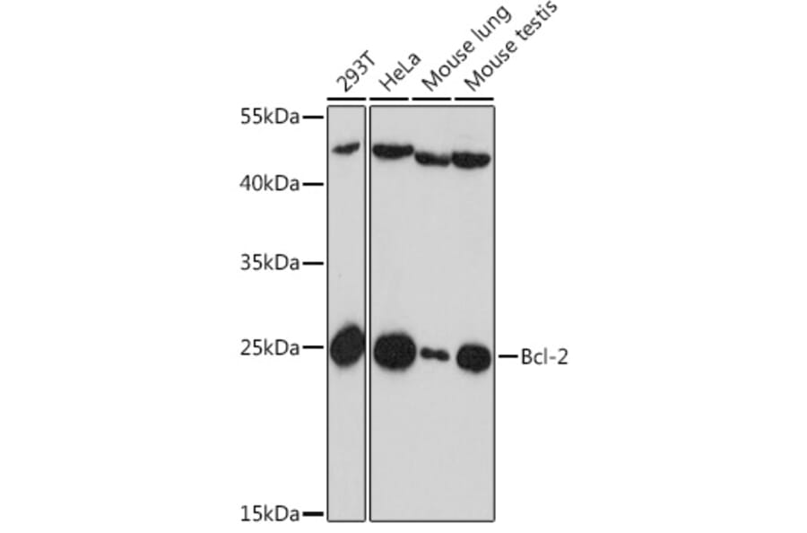 Western Blot - Anti-Bcl-2 Antibody (A88945) - Antibodies.com