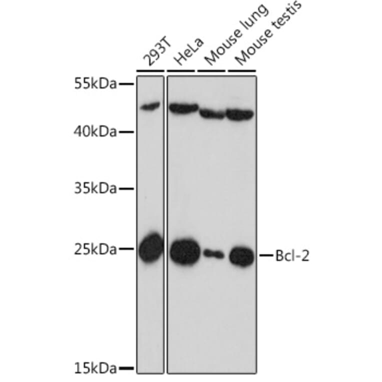 Western Blot - Anti-Bcl-2 Antibody (A88945) - Antibodies.com