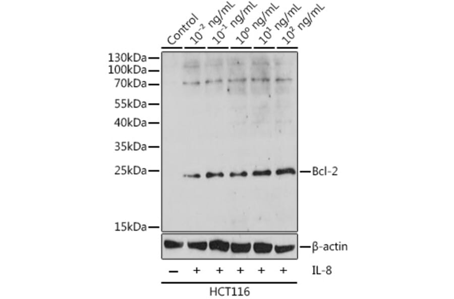 Western Blot - Anti-Bcl-2 Antibody (A88945) - Antibodies.com