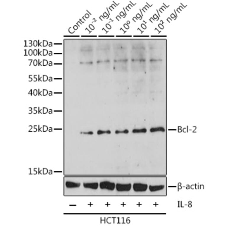Western Blot - Anti-Bcl-2 Antibody (A88945) - Antibodies.com