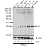 Western Blot - Anti-Bcl-2 Antibody (A88945) - Antibodies.com