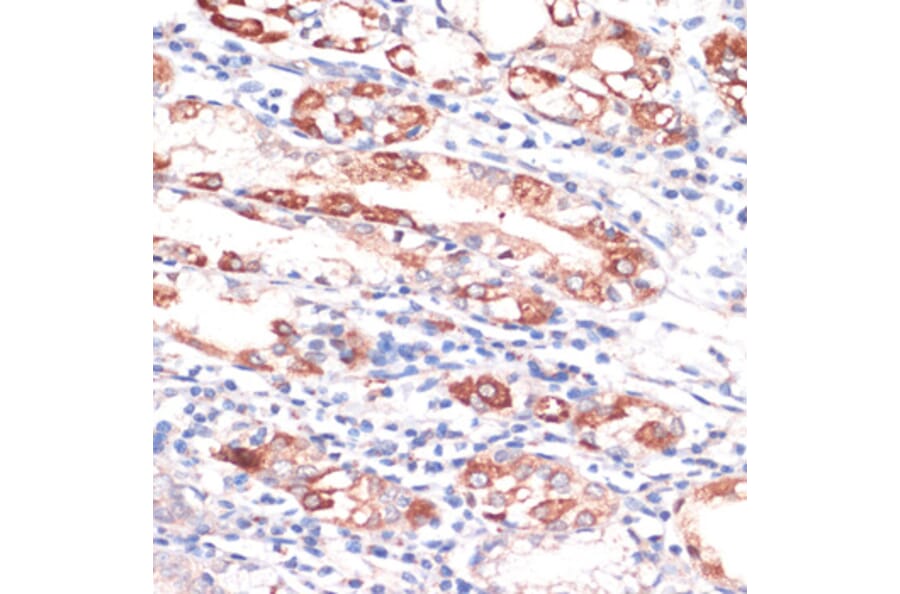 Immunohistochemistry - Anti-Bcl-2 Antibody (A88945) - Antibodies.com