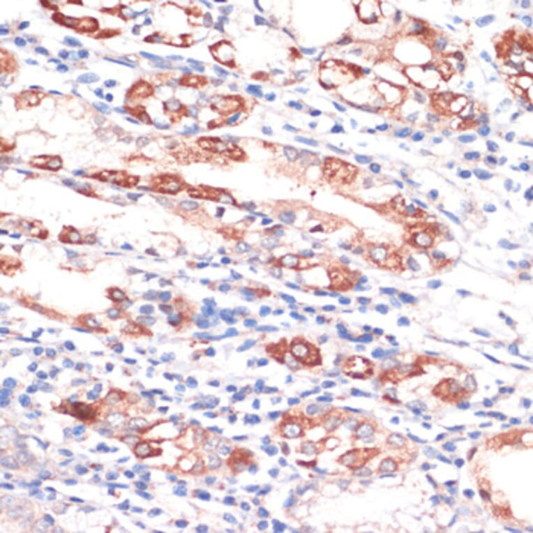 Immunohistochemistry - Anti-Bcl-2 Antibody (A88945) - Antibodies.com