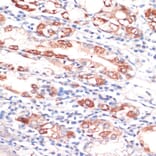Immunohistochemistry - Anti-Bcl-2 Antibody (A88945) - Antibodies.com
