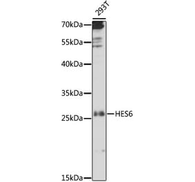 Western Blot - Anti-HES6 Antibody (A88946) - Antibodies.com