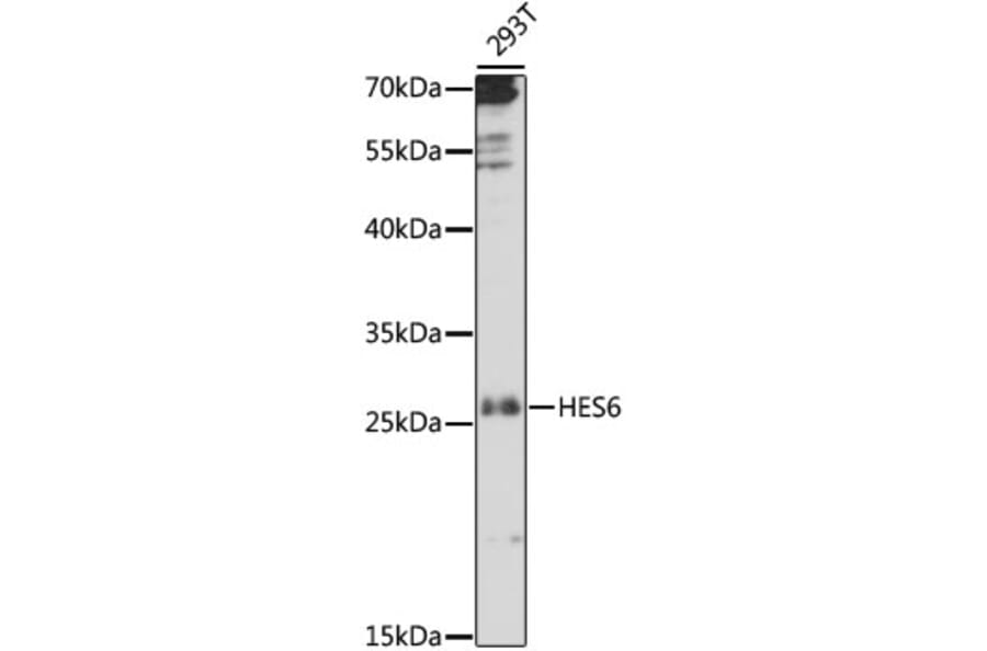 Western Blot - Anti-HES6 Antibody (A88946) - Antibodies.com