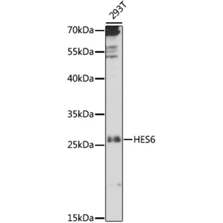 Western Blot - Anti-HES6 Antibody (A88946) - Antibodies.com