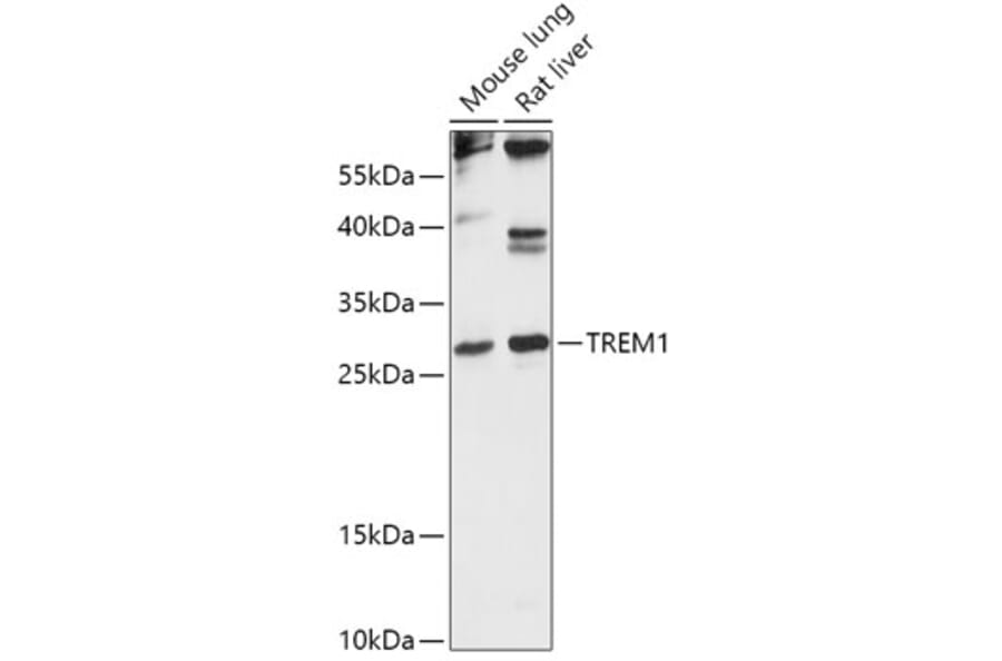 Western Blot - Anti-TREM1 Antibody (A88947) - Antibodies.com