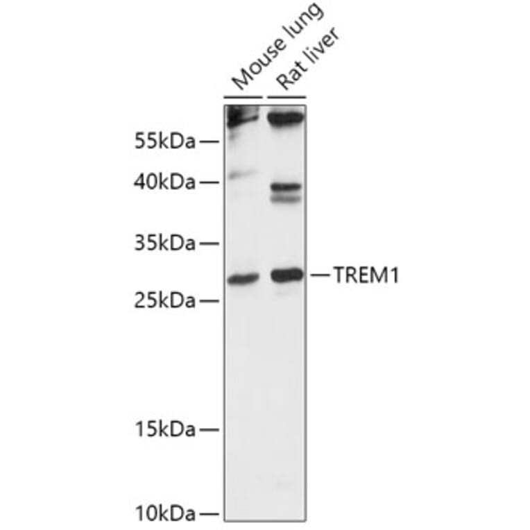 Western Blot - Anti-TREM1 Antibody (A88947) - Antibodies.com