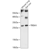 Western Blot - Anti-TREM1 Antibody (A88947) - Antibodies.com