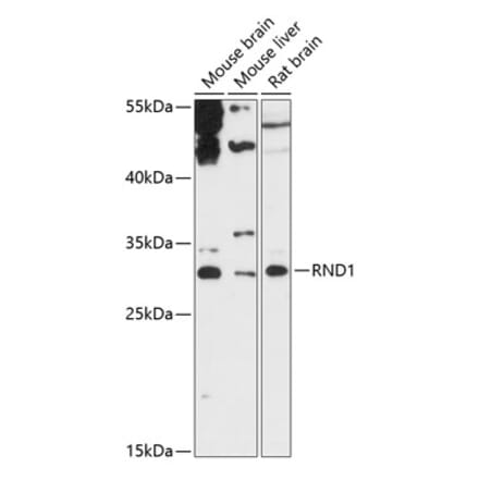 Western Blot - Anti-RND1 Antibody (A88948) - Antibodies.com