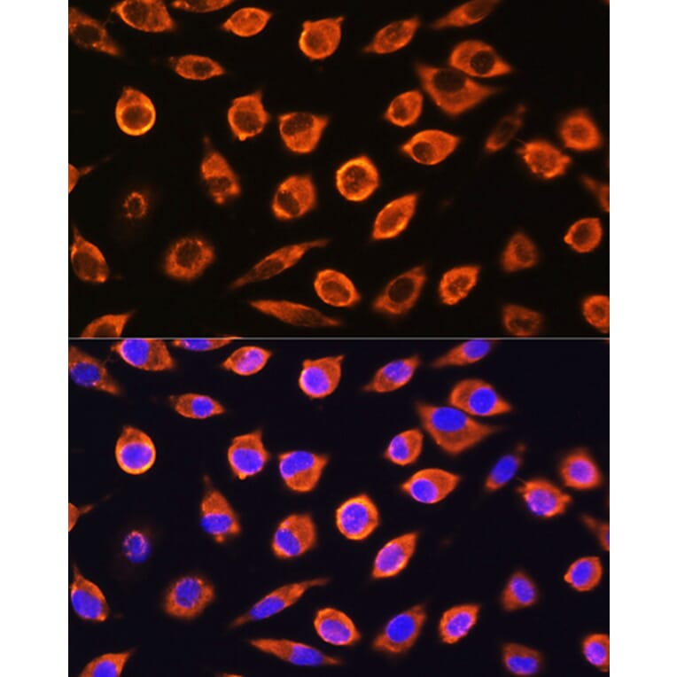 Immunofluorescence - Anti-RND1 Antibody (A88948) - Antibodies.com