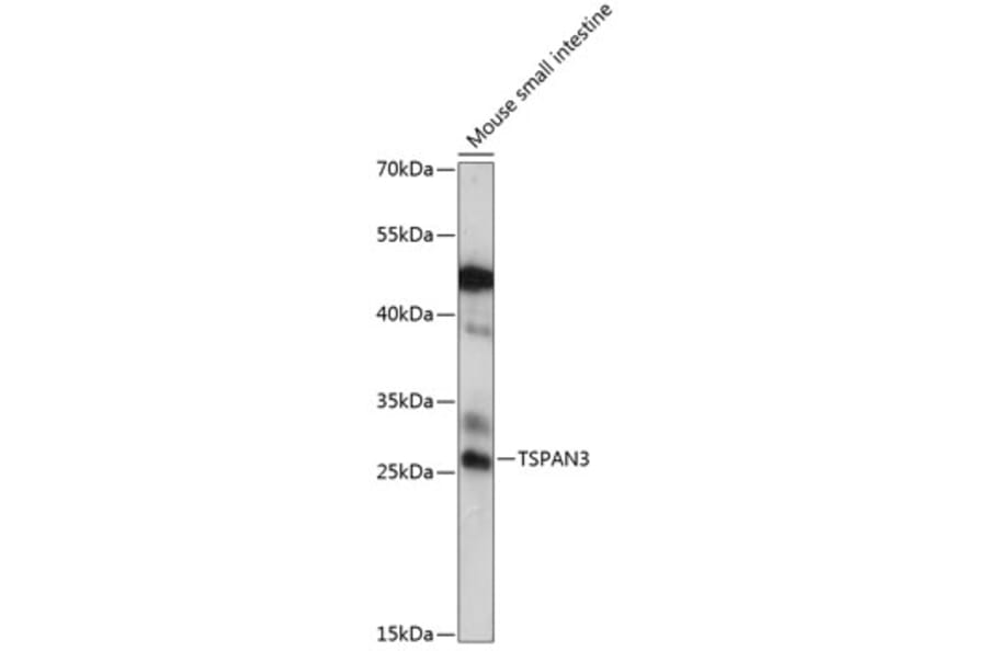 Western Blot - Anti-TSPAN3 Antibody (A88949) - Antibodies.com