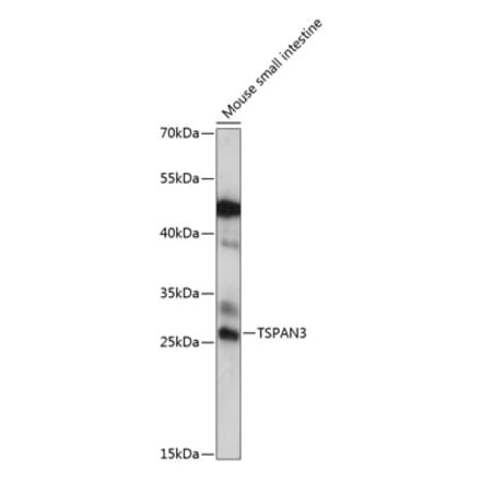 Western Blot - Anti-TSPAN3 Antibody (A88949) - Antibodies.com