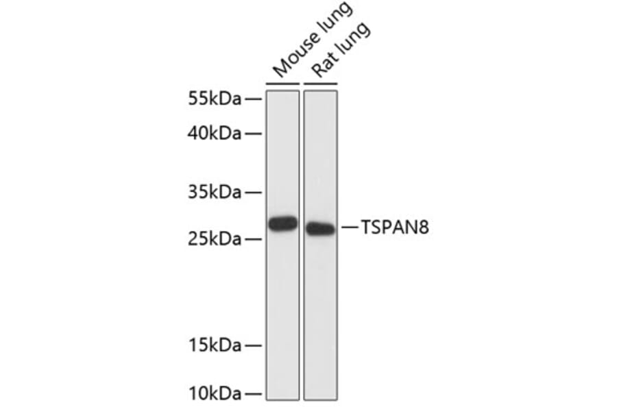 Western Blot - Anti-Tspan-8 Antibody (A88951) - Antibodies.com