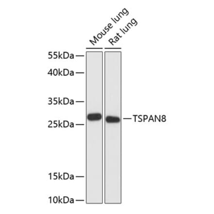 Western Blot - Anti-Tspan-8 Antibody (A88951) - Antibodies.com