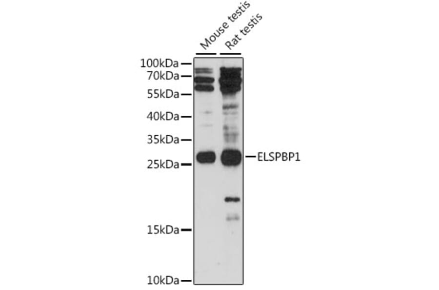 Western Blot - Anti-ELSPBP1 Antibody (A88952) - Antibodies.com