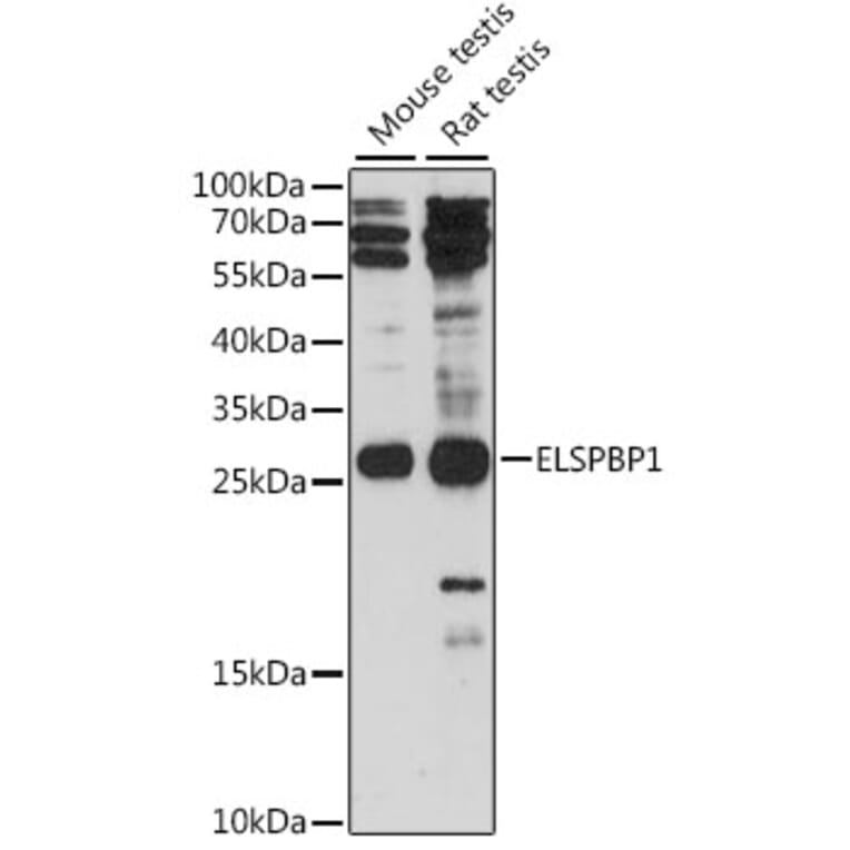 Western Blot - Anti-ELSPBP1 Antibody (A88952) - Antibodies.com
