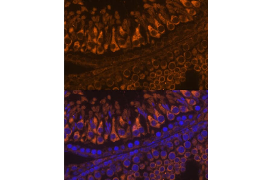 Immunofluorescence - Anti-ELSPBP1 Antibody (A88952) - Antibodies.com