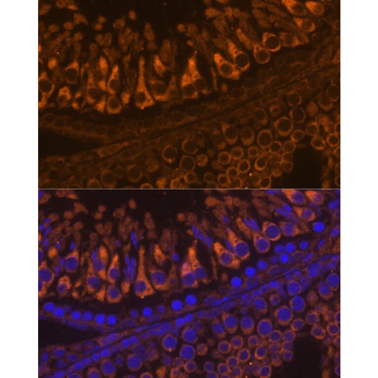 Immunofluorescence - Anti-ELSPBP1 Antibody (A88952) - Antibodies.com