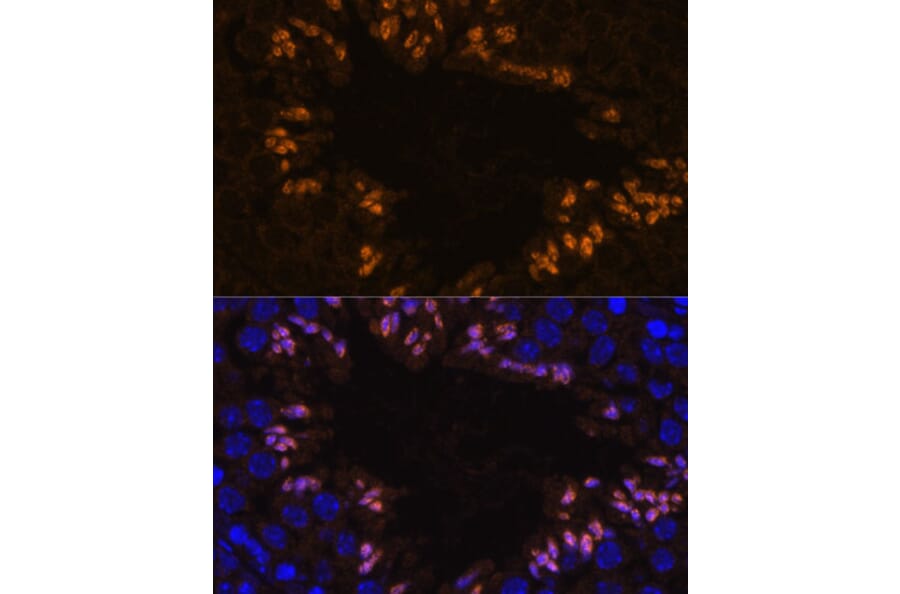 Immunofluorescence - Anti-ELSPBP1 Antibody (A88952) - Antibodies.com